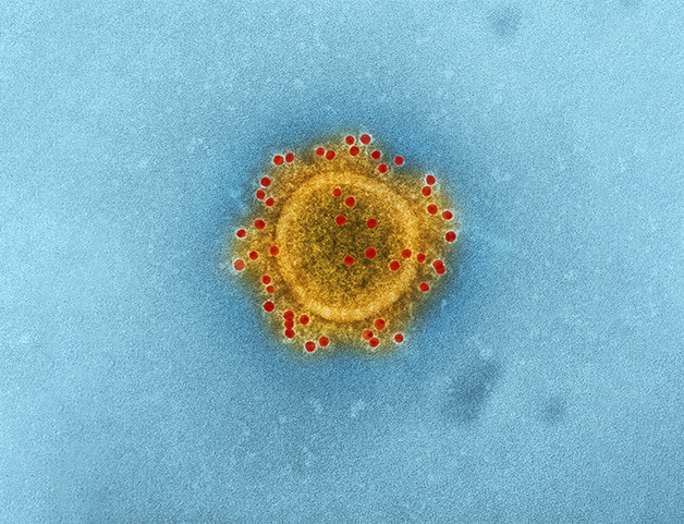 viral infection
